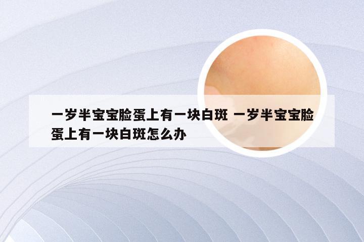 一岁半宝宝脸蛋上有一块白斑 一岁半宝宝脸蛋上有一块白斑怎么办