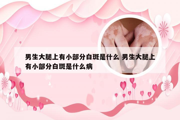 男生大腿上有小部分白斑是什么 男生大腿上有小部分白斑是什么病