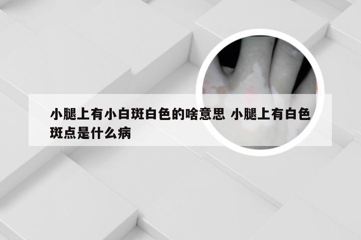 小腿上有小白斑白色的啥意思 小腿上有白色斑点是什么病
