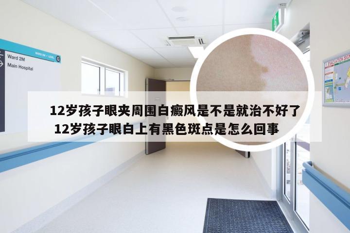 12岁孩子眼夹周围白癜风是不是就治不好了 12岁孩子眼白上有黑色斑点是怎么回事