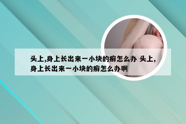 头上,身上长出来一小块的癣怎么办 头上,身上长出来一小块的癣怎么办啊