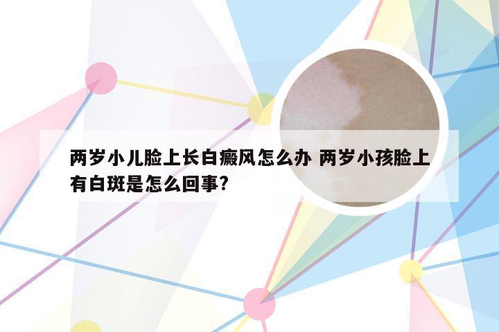 两岁小儿脸上长白癜风怎么办 两岁小孩脸上有白斑是怎么回事?