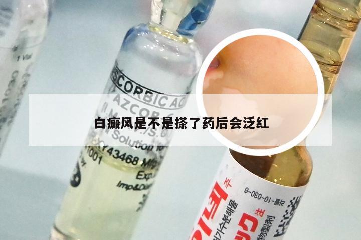 白癜风是不是搽了药后会泛红