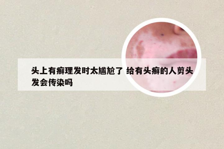 头上有癣理发时太尴尬了 给有头癣的人剪头发会传染吗