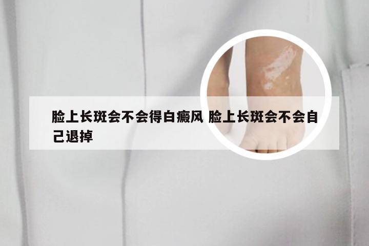 脸上长斑会不会得白癜风 脸上长斑会不会自己退掉
