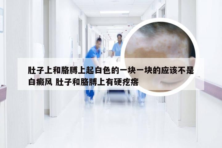 肚子上和胳膊上起白色的一块一块的应该不是白癜风 肚子和胳膊上有硬疙瘩