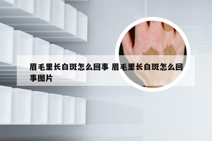 眉毛里长白斑怎么回事 眉毛里长白斑怎么回事图片