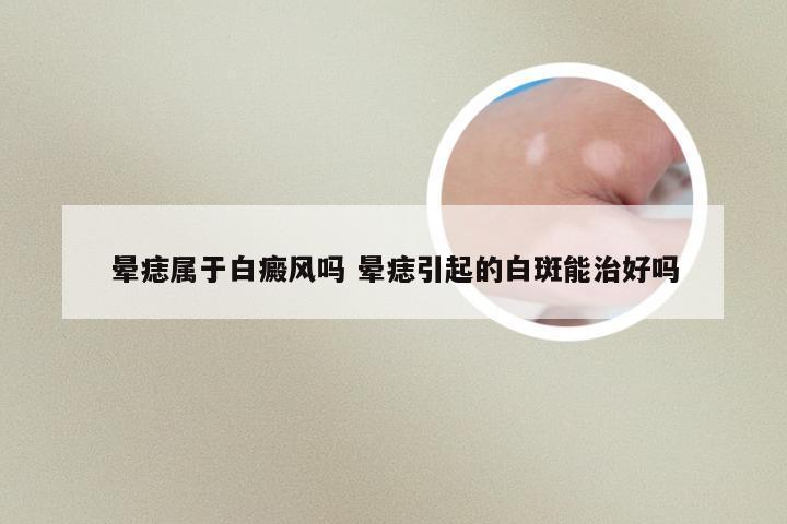 晕痣属于白癜风吗 晕痣引起的白斑能治好吗