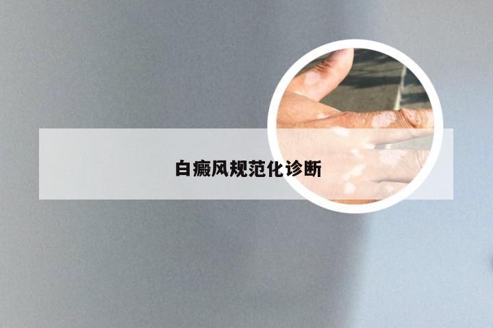 白癜风规范化诊断