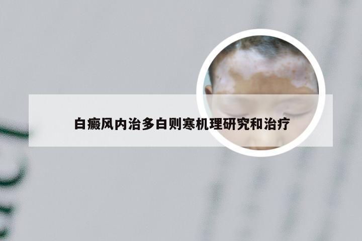 白癜风内治多白则寒机理研究和治疗
