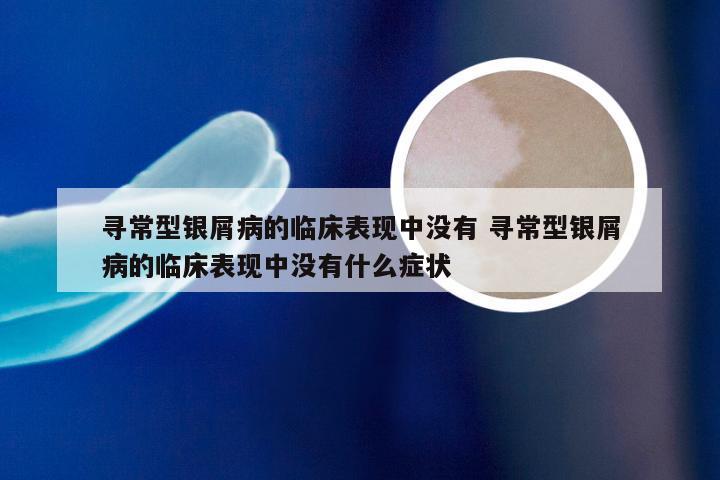 寻常型银屑病的临床表现中没有 寻常型银屑病的临床表现中没有什么症状