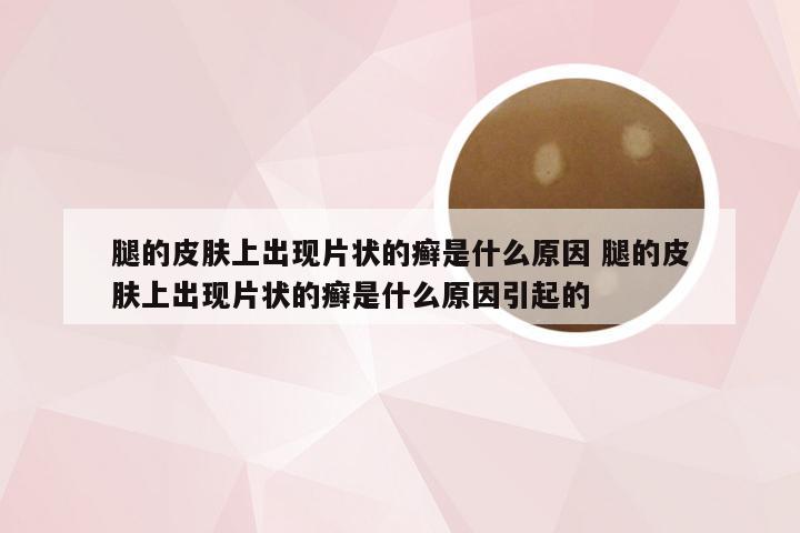 腿的皮肤上出现片状的癣是什么原因 腿的皮肤上出现片状的癣是什么原因引起的