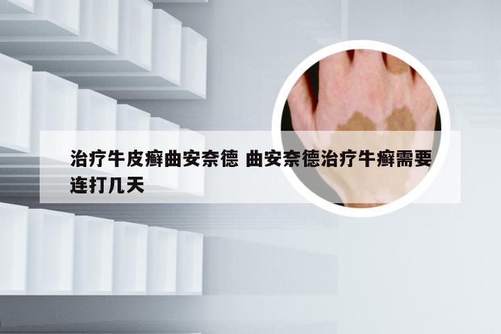 治疗牛皮癣曲安奈德 曲安奈德治疗牛癣需要连打几天