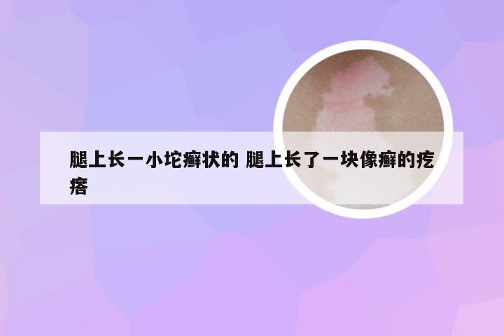 腿上长一小坨癣状的 腿上长了一块像癣的疙瘩