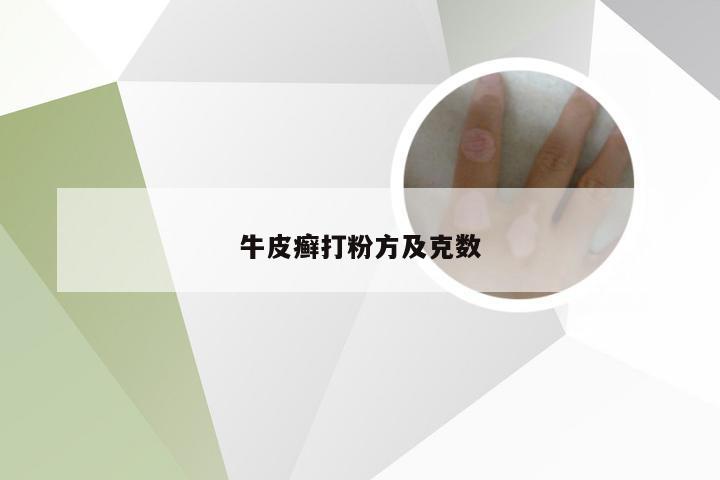 牛皮癣打粉方及克数