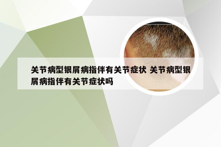关节病型银屑病指伴有关节症状 关节病型银屑病指伴有关节症状吗