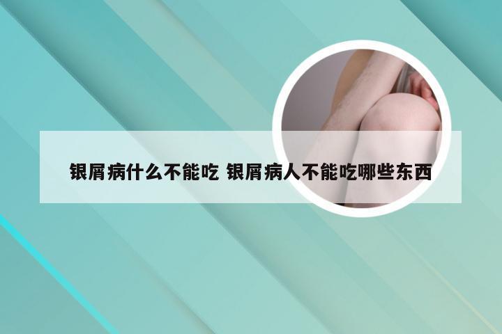 银屑病什么不能吃 银屑病人不能吃哪些东西