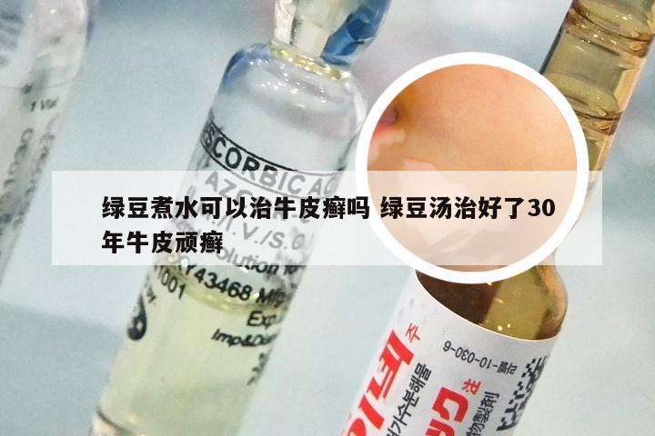 绿豆煮水可以治牛皮癣吗 绿豆汤治好了30年牛皮顽癣
