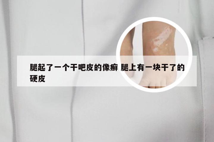 腿起了一个干吧皮的像癣 腿上有一块干了的硬皮