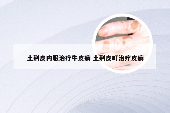 土荆皮内服治疗牛皮癣 土荆皮町治疗皮癣