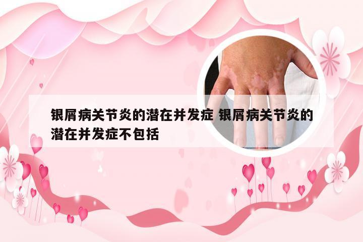 银屑病关节炎的潜在并发症 银屑病关节炎的潜在并发症不包括