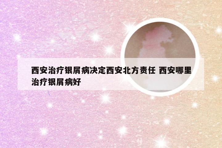 西安治疗银屑病决定西安北方责任 西安哪里治疗银屑病好