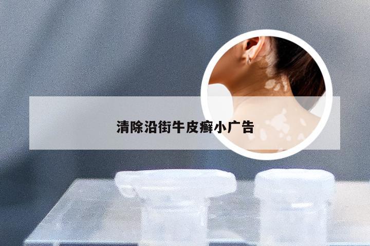 清除沿街牛皮癣小广告