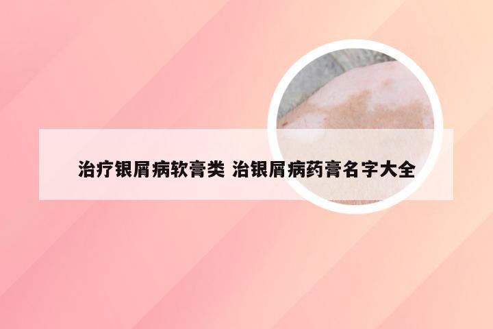 治疗银屑病软膏类 治银屑病药膏名字大全