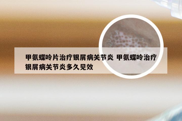 甲氨蝶呤片治疗银屑病关节炎 甲氨蝶呤治疗银屑病关节炎多久见效