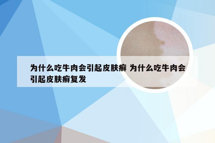 为什么吃牛肉会引起皮肤癣 为什么吃牛肉会引起皮肤癣复发