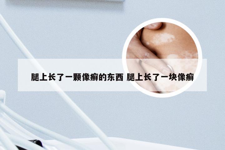 腿上长了一颗像癣的东西 腿上长了一块像癣