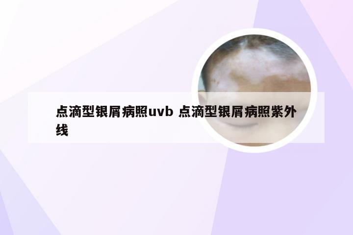 点滴型银屑病照uvb 点滴型银屑病照紫外线