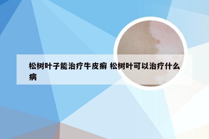 松树叶子能治疗牛皮癣 松树叶可以治疗什么病