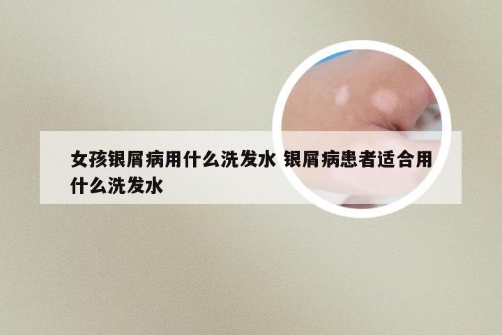 女孩银屑病用什么洗发水 银屑病患者适合用什么洗发水