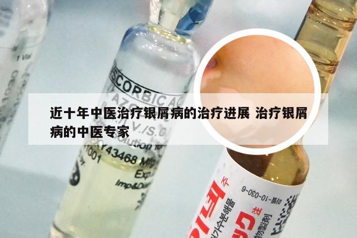 近十年中医治疗银屑病的治疗进展 治疗银屑病的中医专家
