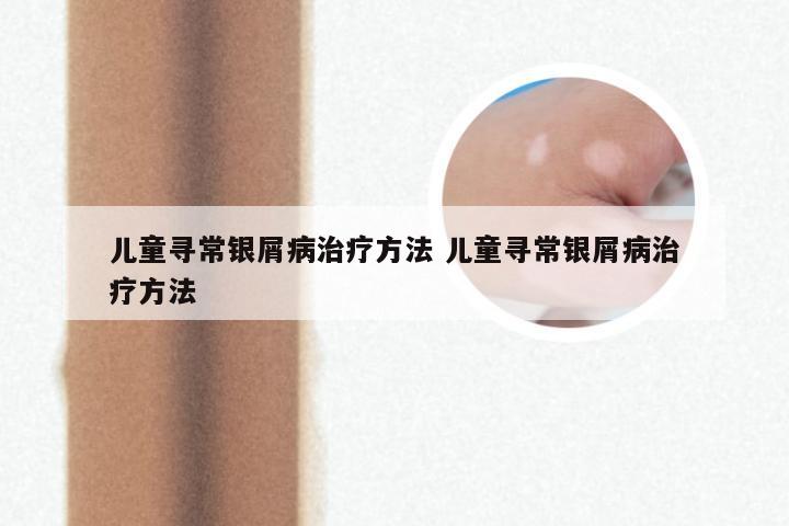 儿童寻常银屑病治疗方法 儿童寻常银屑病治疗方法