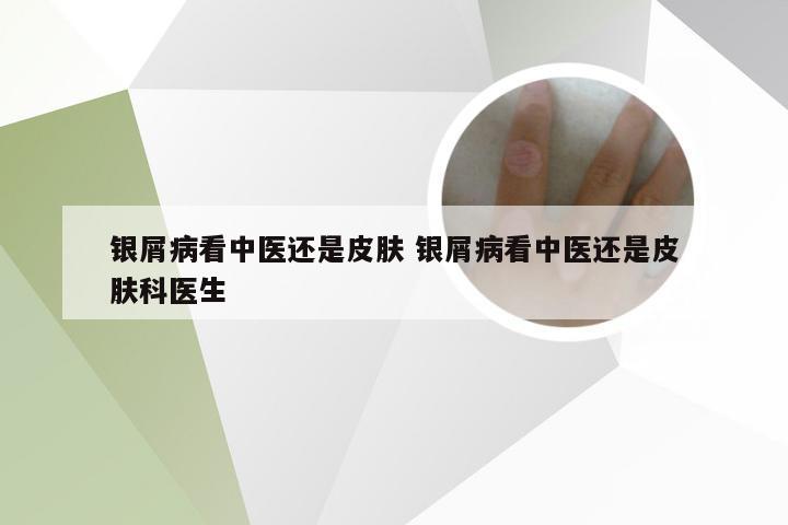 银屑病看中医还是皮肤 银屑病看中医还是皮肤科医生