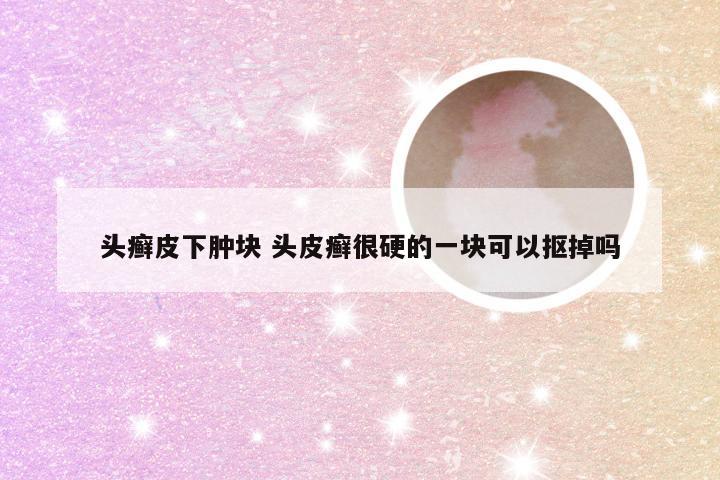 头癣皮下肿块 头皮癣很硬的一块可以抠掉吗