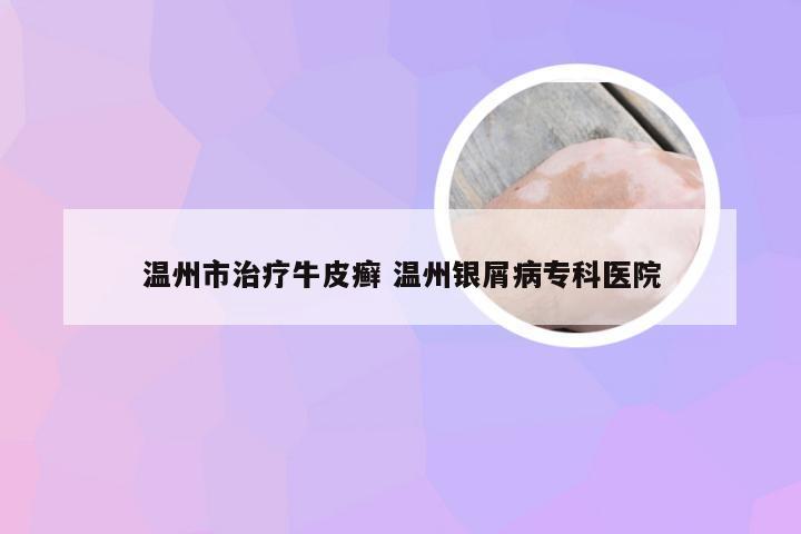 温州市治疗牛皮癣 温州银屑病专科医院