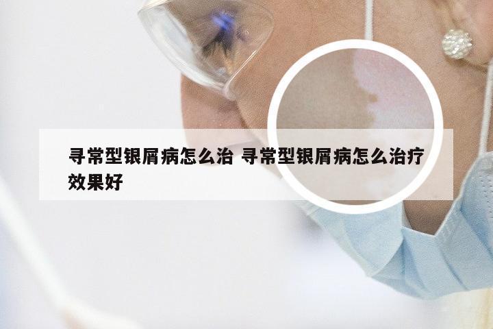 寻常型银屑病怎么治 寻常型银屑病怎么治疗效果好