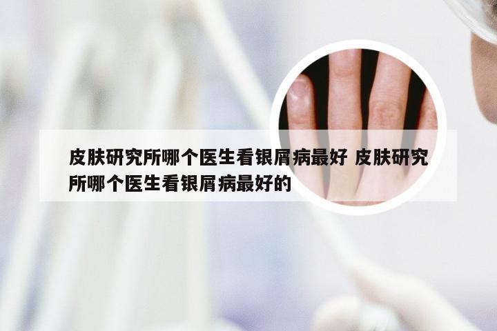 皮肤研究所哪个医生看银屑病最好 皮肤研究所哪个医生看银屑病最好的
