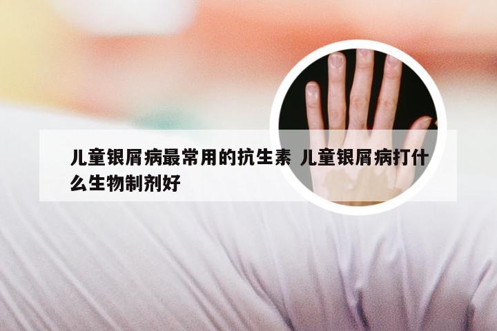 儿童银屑病最常用的抗生素 儿童银屑病打什么生物制剂好