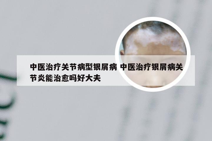中医治疗关节病型银屑病 中医治疗银屑病关节炎能治愈吗好大夫