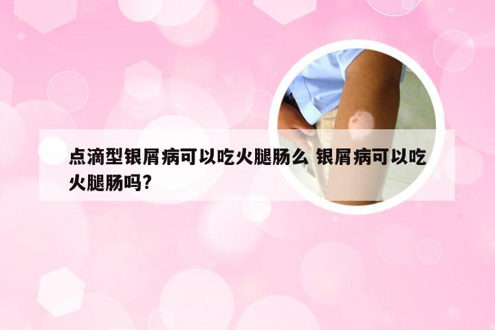 点滴型银屑病可以吃火腿肠么 银屑病可以吃火腿肠吗?