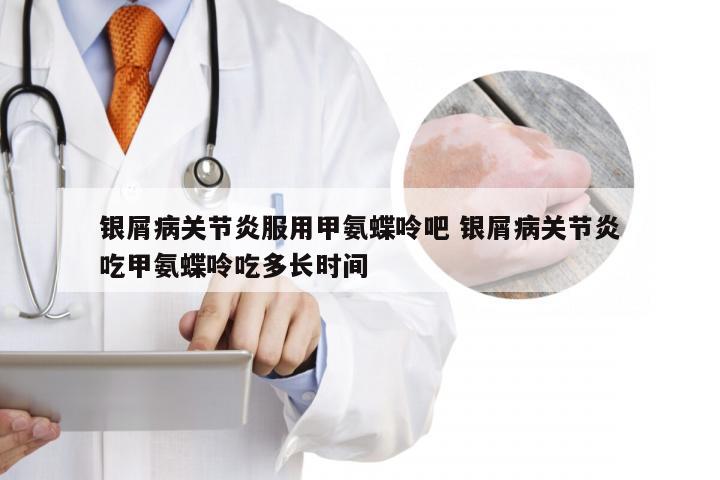 银屑病关节炎服用甲氨蝶呤吧 银屑病关节炎吃甲氨蝶呤吃多长时间