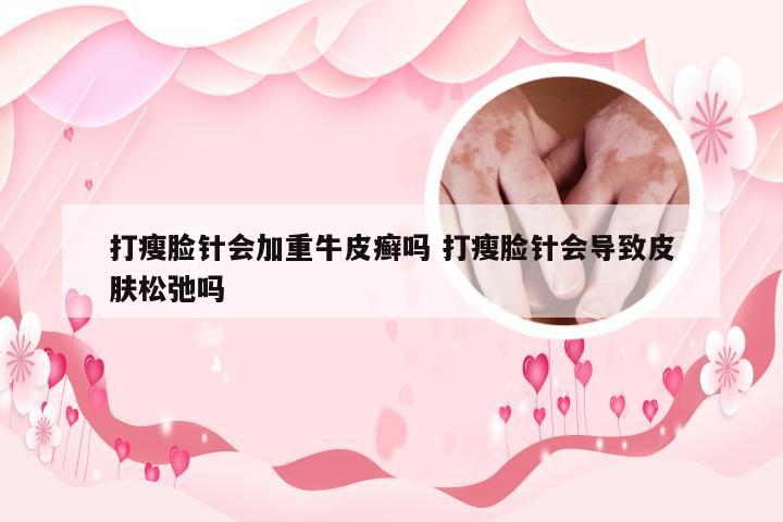打瘦脸针会加重牛皮癣吗 打瘦脸针会导致皮肤松弛吗