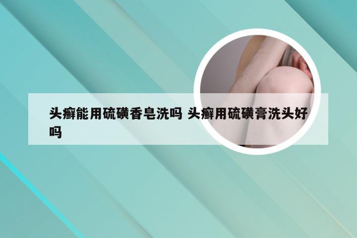 头癣能用硫磺香皂洗吗 头癣用硫磺膏洗头好吗