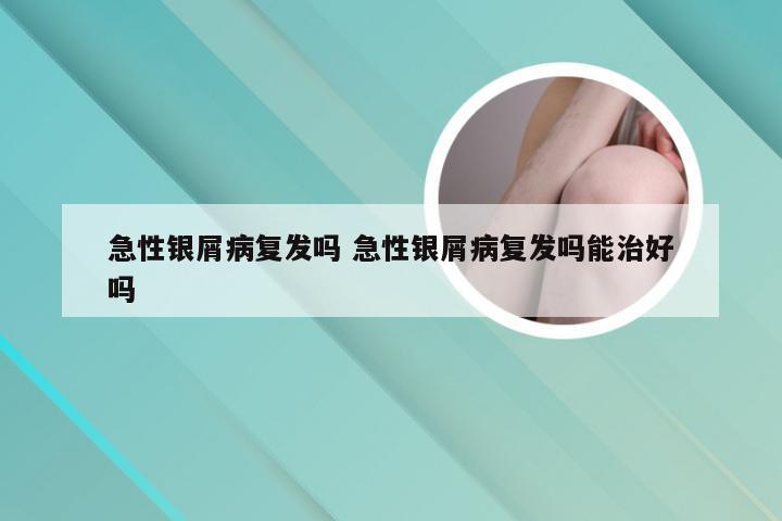 急性银屑病复发吗 急性银屑病复发吗能治好吗