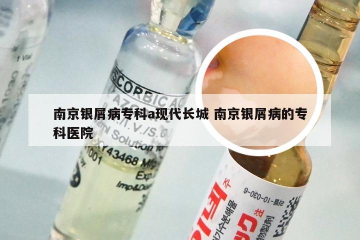 南京银屑病专科a现代长城 南京银屑病的专科医院