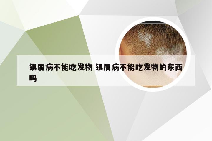 银屑病不能吃发物 银屑病不能吃发物的东西吗